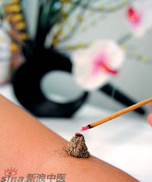 節(jié)氣灸” 冬至，你灸了嗎？