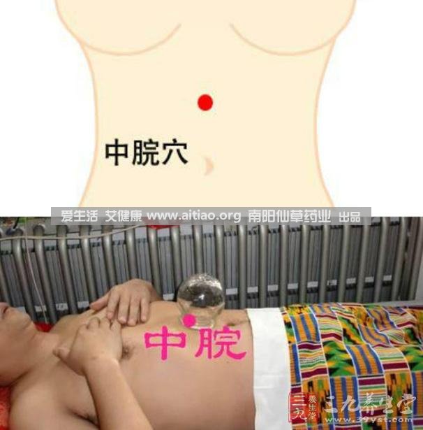 中脘穴位于腹部正中線，臍上4寸的位置上。每天艾灸10-15分鐘，能有效緩解胃部不適的癥狀，同時(shí)有助于祛濕。